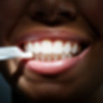 teeth whitening